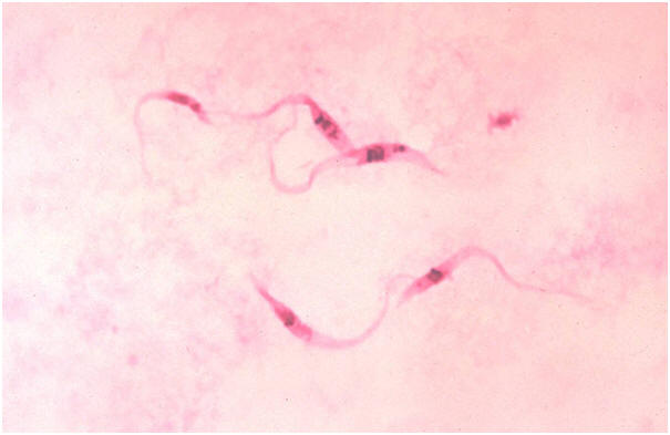 parasite