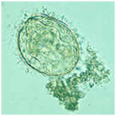 Schistosomiasis clip art